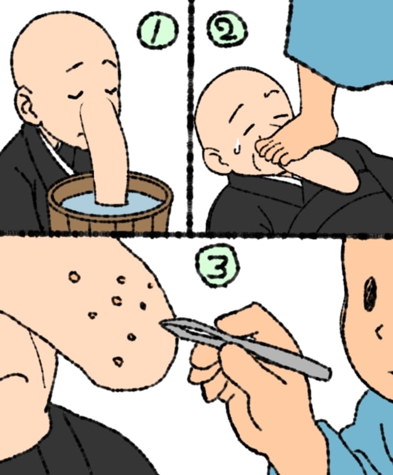 ①鼻を熱湯でゆでる
②鼻を足で踏む
③ピンセットで毛穴から脂（角栓）を抜く
イラスト