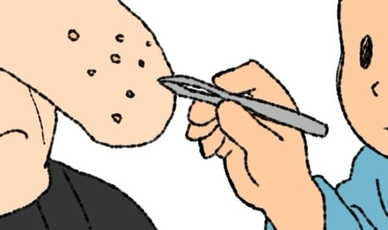 毛穴から脂を抜く